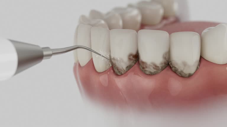 Trusted Wisdom Tooth Removal service in Colchester, IL - Dentist Open Now